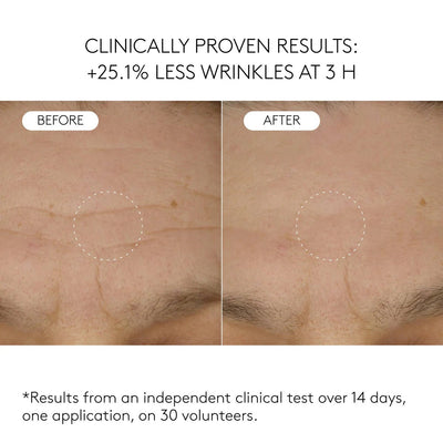LUMÉVIA™ Blue Spicule Renewal Treatment