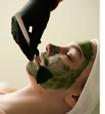 In-Office Microneedling